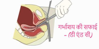 DNC Full Form डी एंड सी क्या है in Hindi
