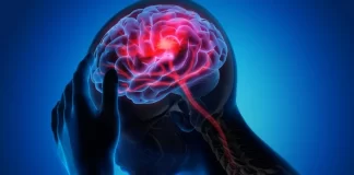 Brain Cancer Symptoms and Treatment