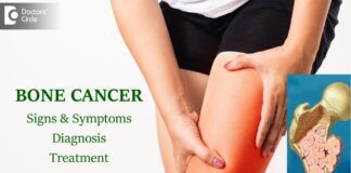 Bone Cancer Symptoms and Treatment