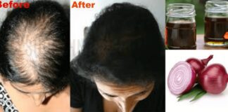 Onion Juice For Hair Growth (प्याज का रस)