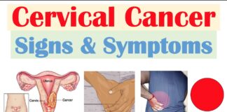 Cervical Cancer Symptoms and Treatment