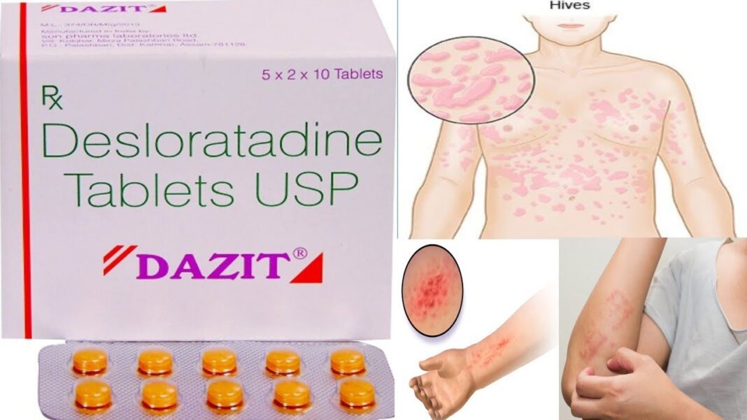 Desloratadine Tablet Effects and Side Effects Desloratadine Tablet Effects and Side Effects in hindi