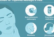 Trigeminal Neuralgia Tablet and Side Effects Trigeminal Neuralgia Tablet