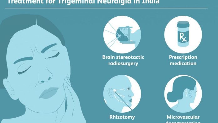 Trigeminal Neuralgia Tablet and Side Effects Trigeminal Neuralgia Tablet